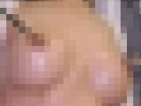 【婦人科外来】乳首過敏症【カルテNo.205イクイク病事例】乳頭ホルモン放出施術